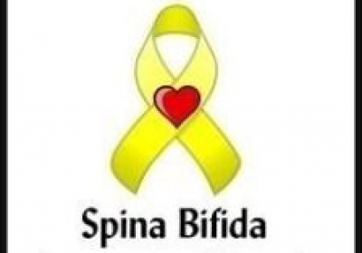 Meningocele (Spina Bifida)