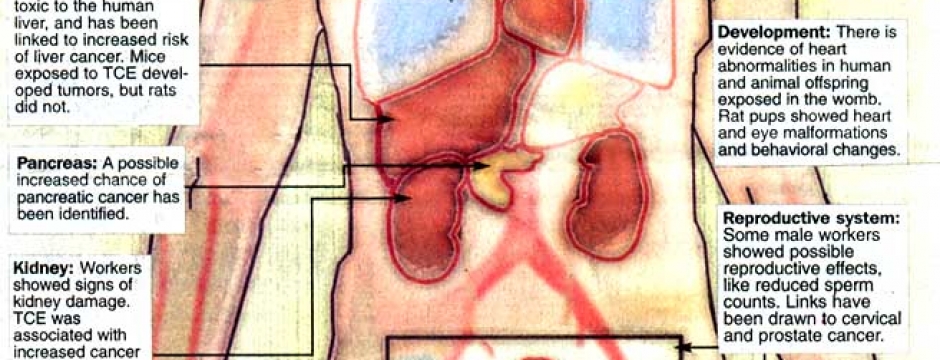 The effects of TCE on the human body