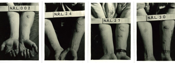 Secret World War II Chemical Experiments Tested Troops By Race