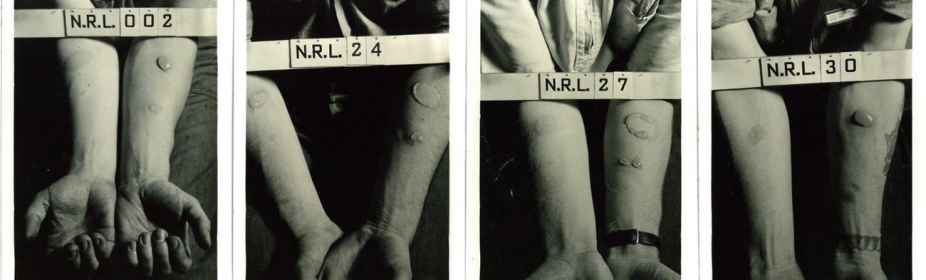 Secret World War II Chemical Experiments Tested Troops By Race