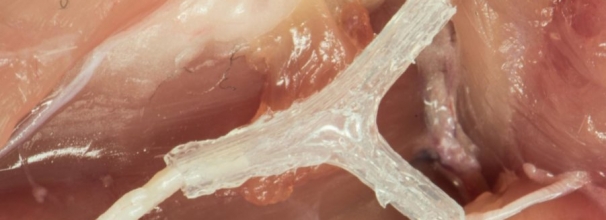 Nerve Regeneration