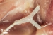 Nerve Regeneration