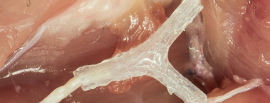Nerve Regeneration